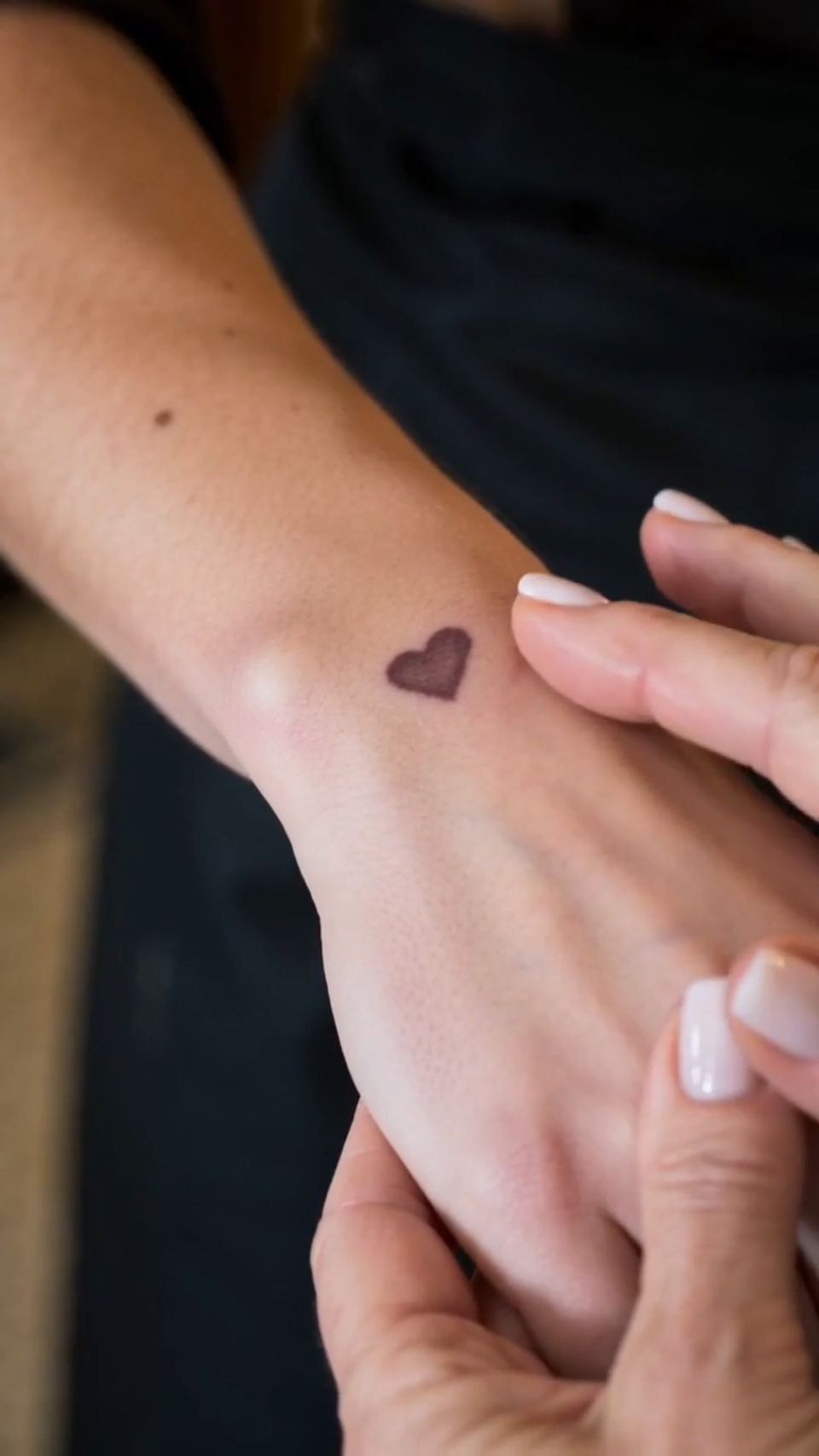 She Grabbed the Waitress's Arm Over a Heart-Shaped Birthmark